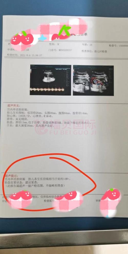 潮汕褚女士24岁子宫内膜异位，三代试管婴儿一次好孕怀上男宝