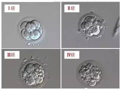 三代试管婴儿胚胎培养一切正常，为什么就是不成功？