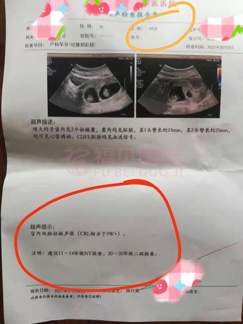 今天袁姐怀上双胎宝宝第63天，发来她的B超报告，胎心妥妥的稳。