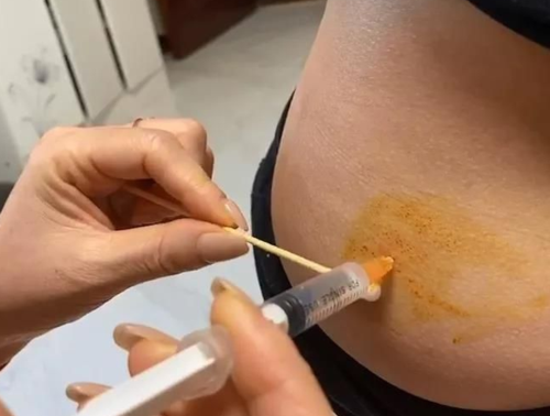 什么是降调针？降调针什么时候打？打完多久可促排？